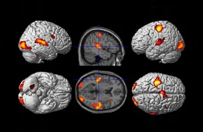 Die Hirnaktivität lässt sich farbig darstellen, wenn man das Hirn mittels Magnetresonanz-Tomografie durchleuchtet. Abb.: Benjamin Straube